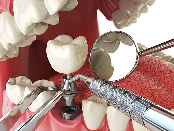 Best Weekend Emergency Dentist in Pelican Marsh, FL